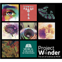 Project Wonder